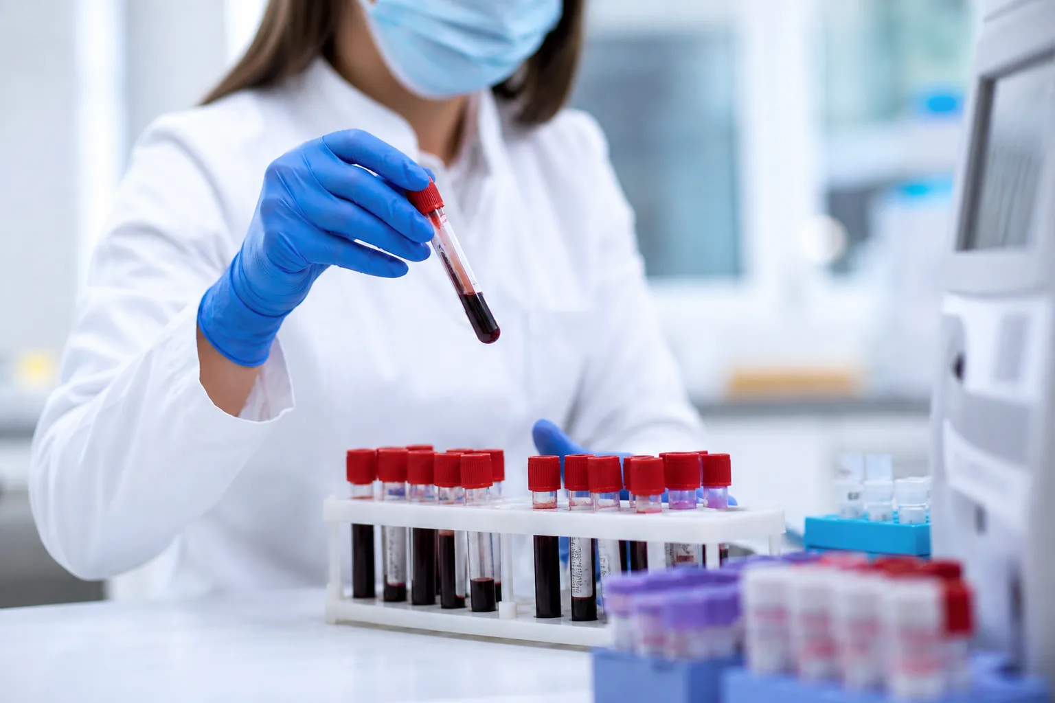 Cholesterol a homocysteina – co warto wiedzieć?