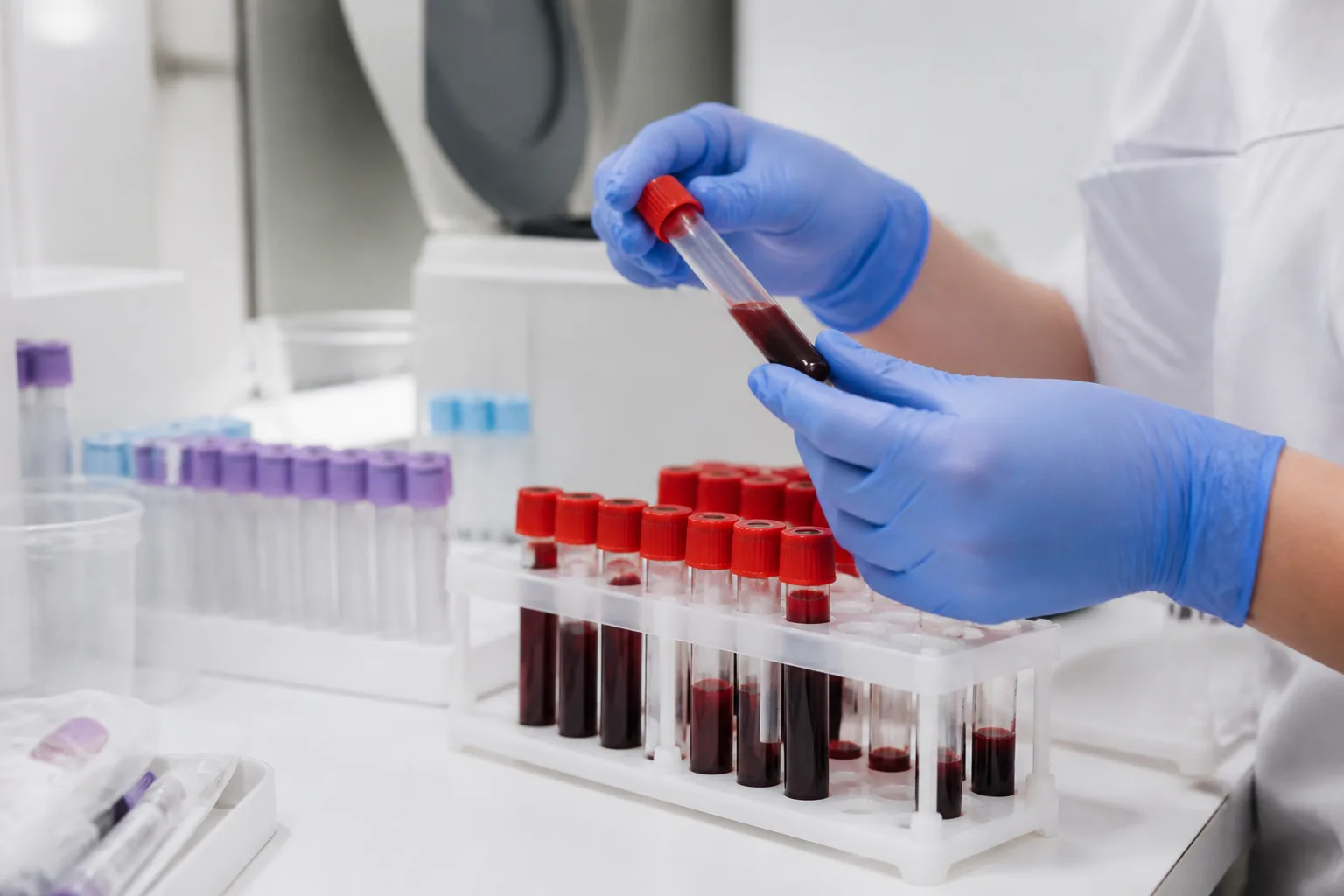Jak zwiększyć testosteron? Naturalne metody, suplementy i leczenie