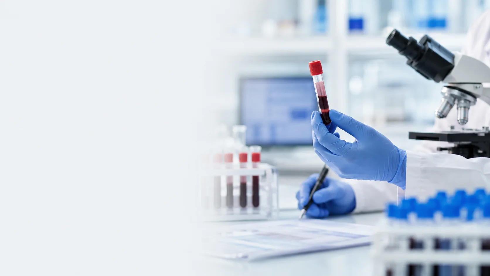 Grafika przedstawiająca temat artykułu: Wirus HIV – objawy, diagnostyka i leczenie