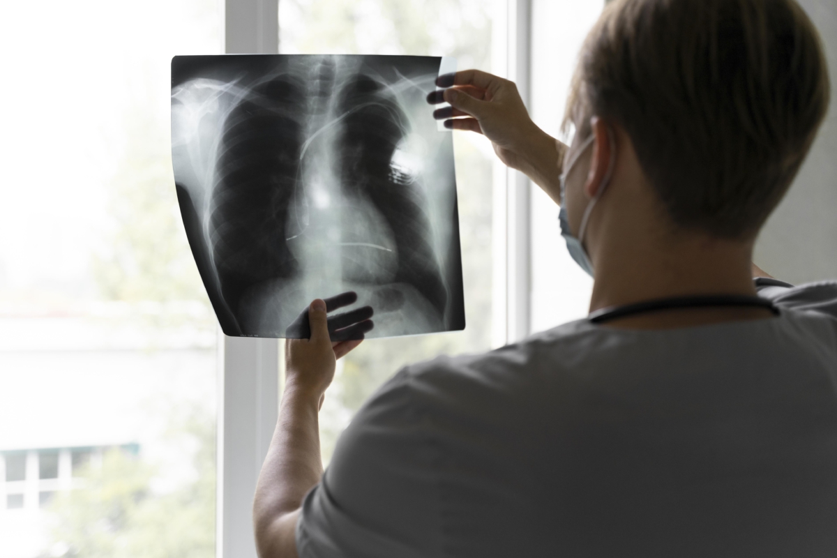lekarz ogląda badanie obrazowe płuc